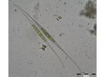 Closterium setaceum