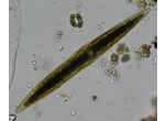 Closterium subfusiforme