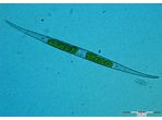 Closterium subulatum