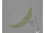 Closterium tumidulum