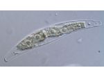 Closterium tumidum