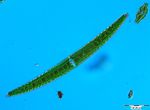 Closterium turgidum