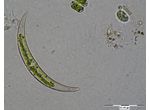 Closterium venus