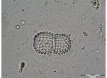 Cosmarium amoenum