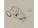 Cosmarium anceps