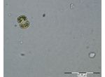 Cosmarium angulosum