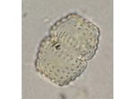 Cosmarium basiornatum