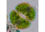 Cosmarium botrytis
