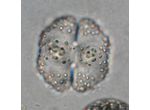 Cosmarium corbula