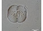Cosmarium fastidiosum