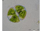Cosmarium formosulum