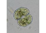 Cosmarium gibberulum