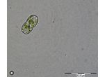 Cosmarium goniodes