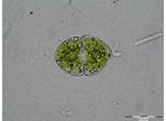Cosmarium granatum