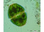 Cosmarium hornavanense