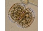 Cosmarium kirchneri