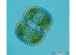 Cosmarium margaritatum