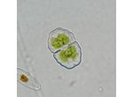 Cosmarium pokornyanum
