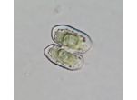 Cosmarium