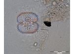 Cosmarium pseudoornatum