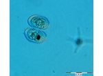 Cosmarium pseudoprotuberans