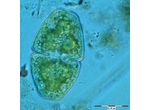 Cosmarium pyramidatum