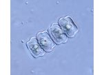Cosmarium quadratulum