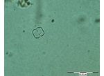 Cosmarium regnelii
