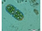 Cosmarium simplicius