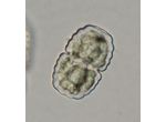 Cosmarium sp