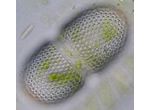 Cosmarium striolatum