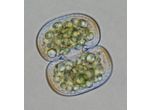 Cosmarium subtumidum