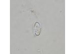 Cosmarium truncatellum