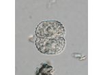 Cosmarium vogesiacum