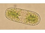 Cylindrocystis brebissonii