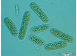 Cylindrocystis
