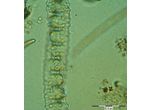 Desmidium aptogonum