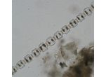 Desmidium