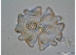 Euastrum verrucosum