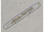 Haplotaenium minutum