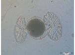 Micrasterias papillifera