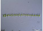 Onychonema