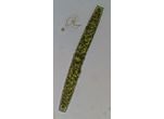 Pleurotaenium crenulatum