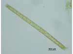 Pleurotaenium ehrenbergii