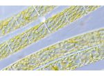 Spirogyra