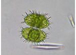 Staurastrum teliferum