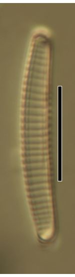 Eunotia glacialis
