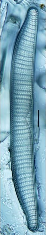 Epithemia adnata
