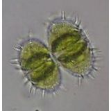 Staurastrum teliferum
