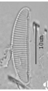 Eunotia incisa